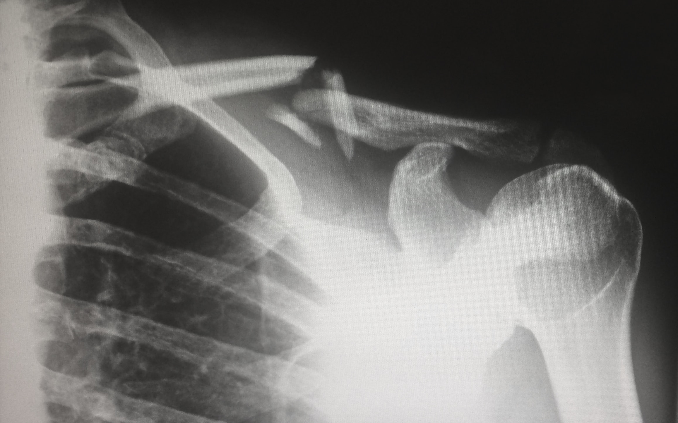skeleton x-ray