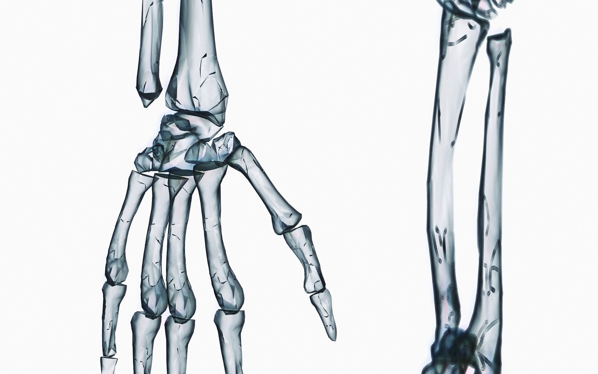 Digital Radiography