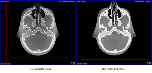 CBCT Software Tools