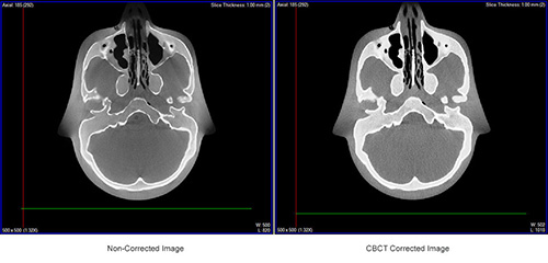 CBCT Software Tools